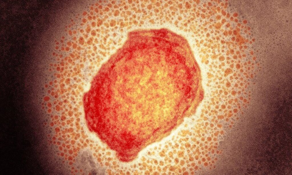 Monkeypox virus particle