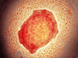 Monkeypox virus particle